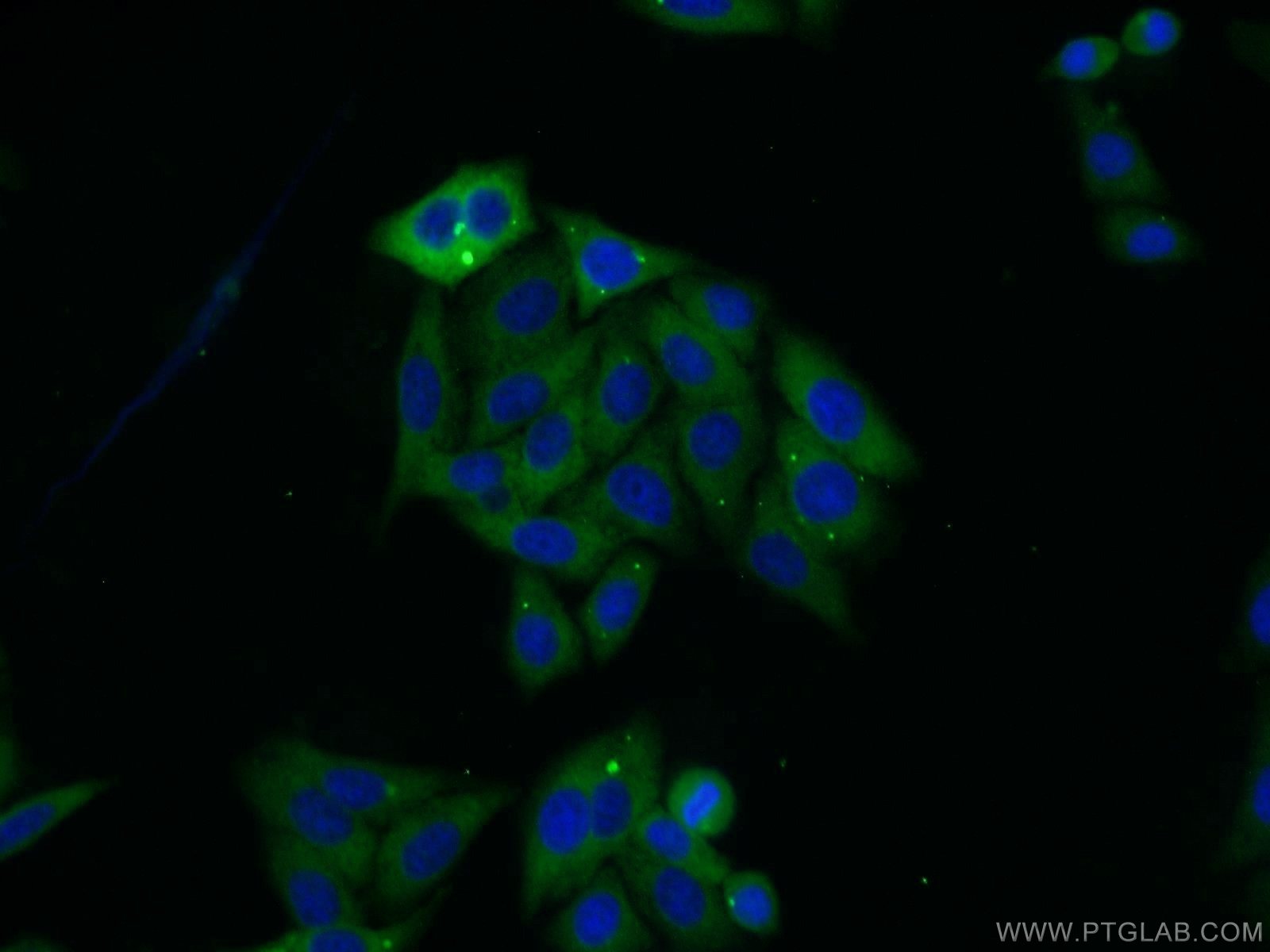 Immunofluorescence (IF) / fluorescent staining of HepG2 cells using SARS Polyclonal antibody (15162-1-AP)