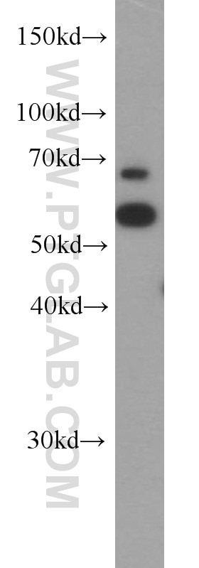 Western Blot (WB) analysis of HeLa cells using SARS Polyclonal antibody (15162-1-AP)