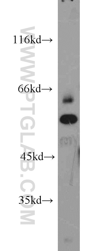 Western Blot (WB) analysis of HeLa cells using SARS Polyclonal antibody (15162-1-AP)