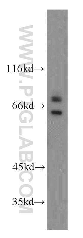 Western Blot (WB) analysis of HEK-293 cells using SARS Polyclonal antibody (15162-1-AP)
