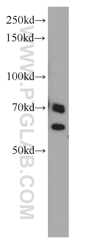 Western Blot (WB) analysis of HepG2 cells using SARS Polyclonal antibody (15162-1-AP)