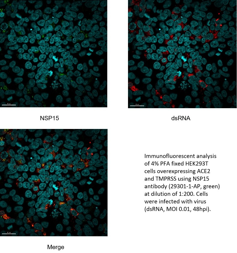 Immunofluorescence (IF) / fluorescent staining of HEK-293T cells using SARS-COV-2 NSP15 Polyclonal antibody (29301-1-AP)