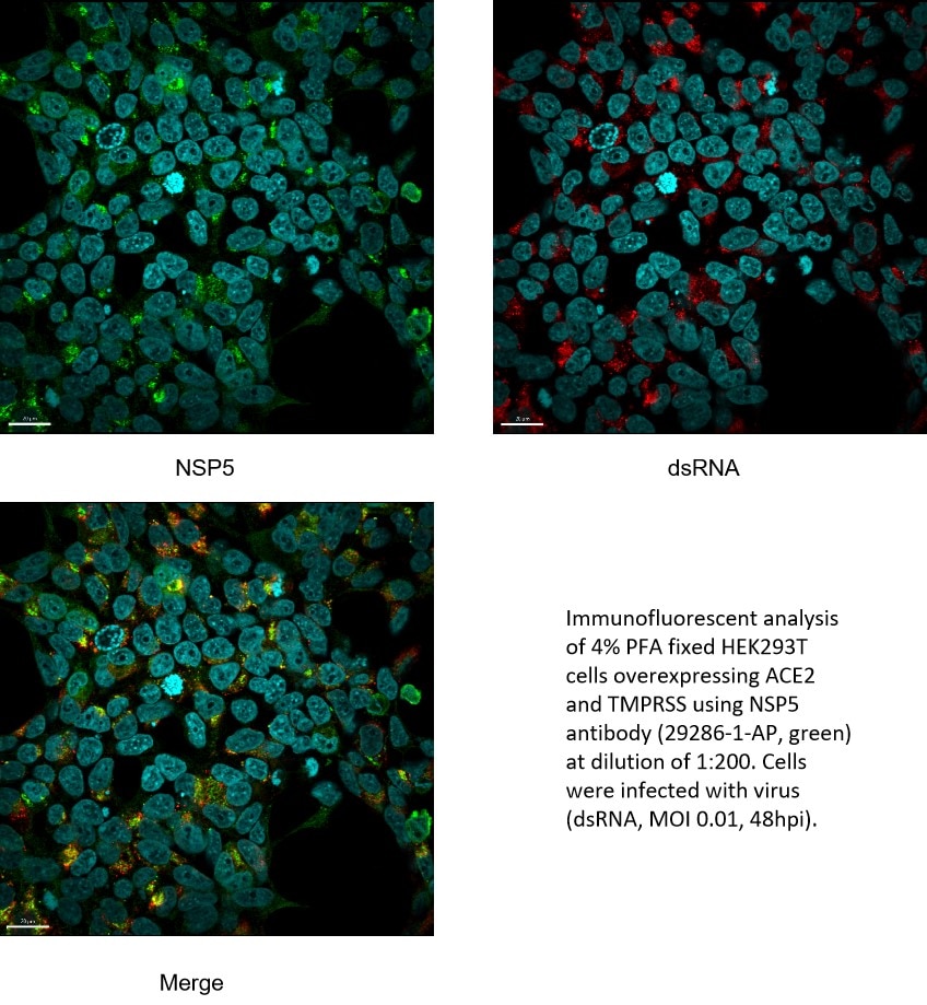 Immunofluorescence (IF) / fluorescent staining of HEK-293T cells using SARS-COV-2 NSP5 Polyclonal antibody (29286-1-AP)
