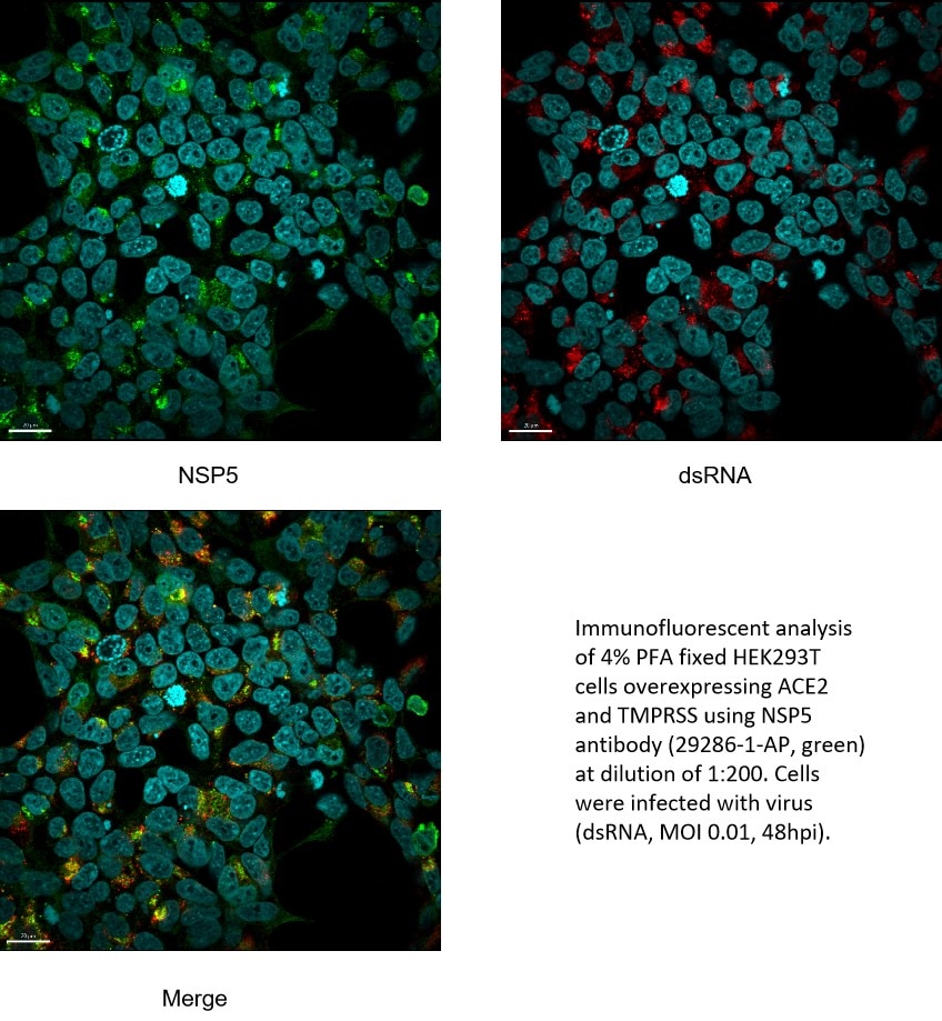 SARS-COV-2 NSP5