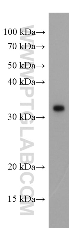 Western Blot (WB) analysis of Recombinant protein using SARS-CoV-2 S protein (944-1214 aa) Monoclonal anti (67794-1-Ig)