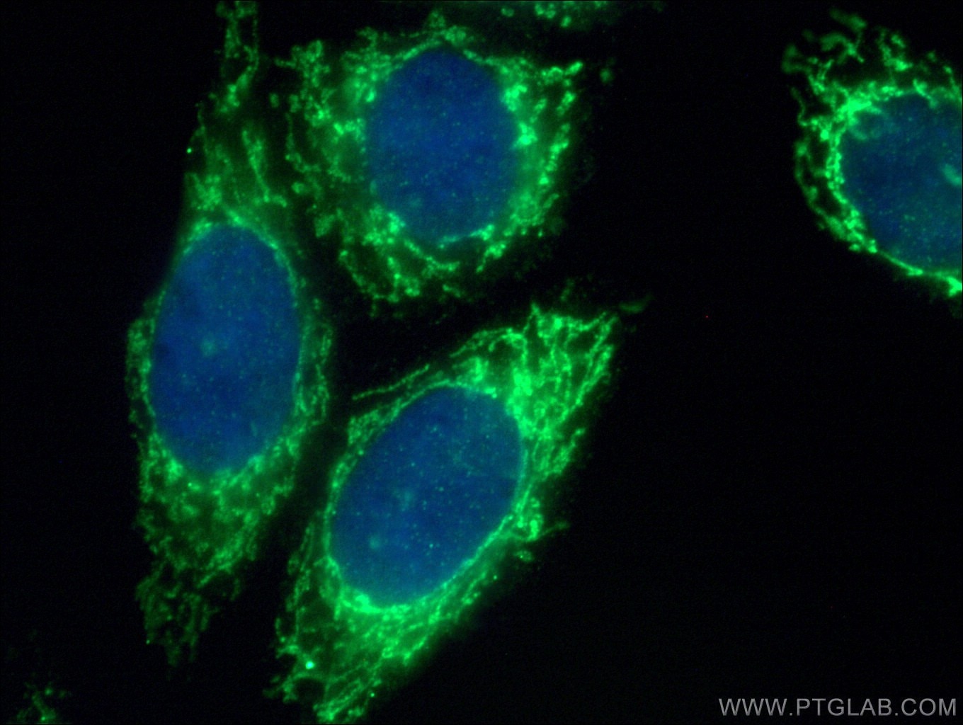 Immunofluorescence (IF) / fluorescent staining of HepG2 cells using SARS2 Polyclonal antibody (17258-1-AP)
