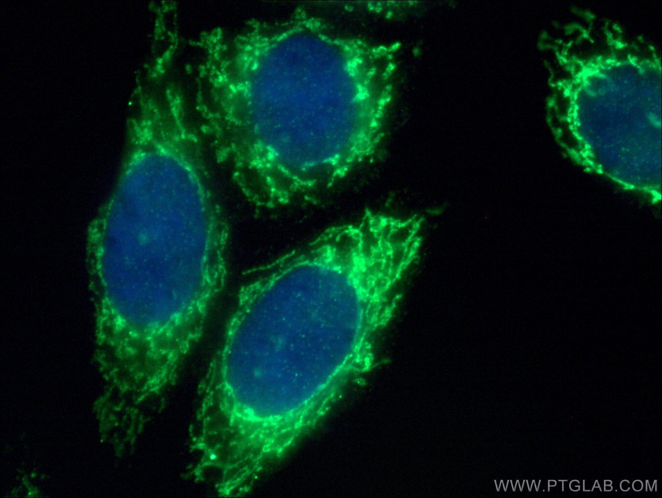 IF Staining of HepG2 using 17258-1-AP