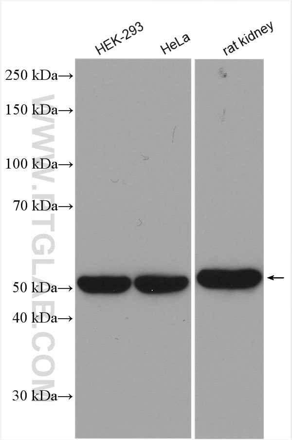 Western Blot (WB) analysis of various lysates using SARS2 Polyclonal antibody (17258-1-AP)