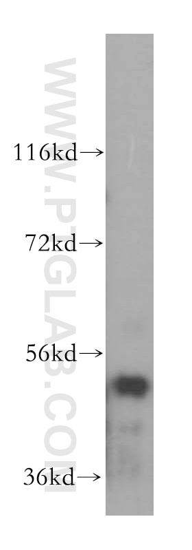 Western Blot (WB) analysis of HeLa cells using SARS2 Polyclonal antibody (17258-1-AP)