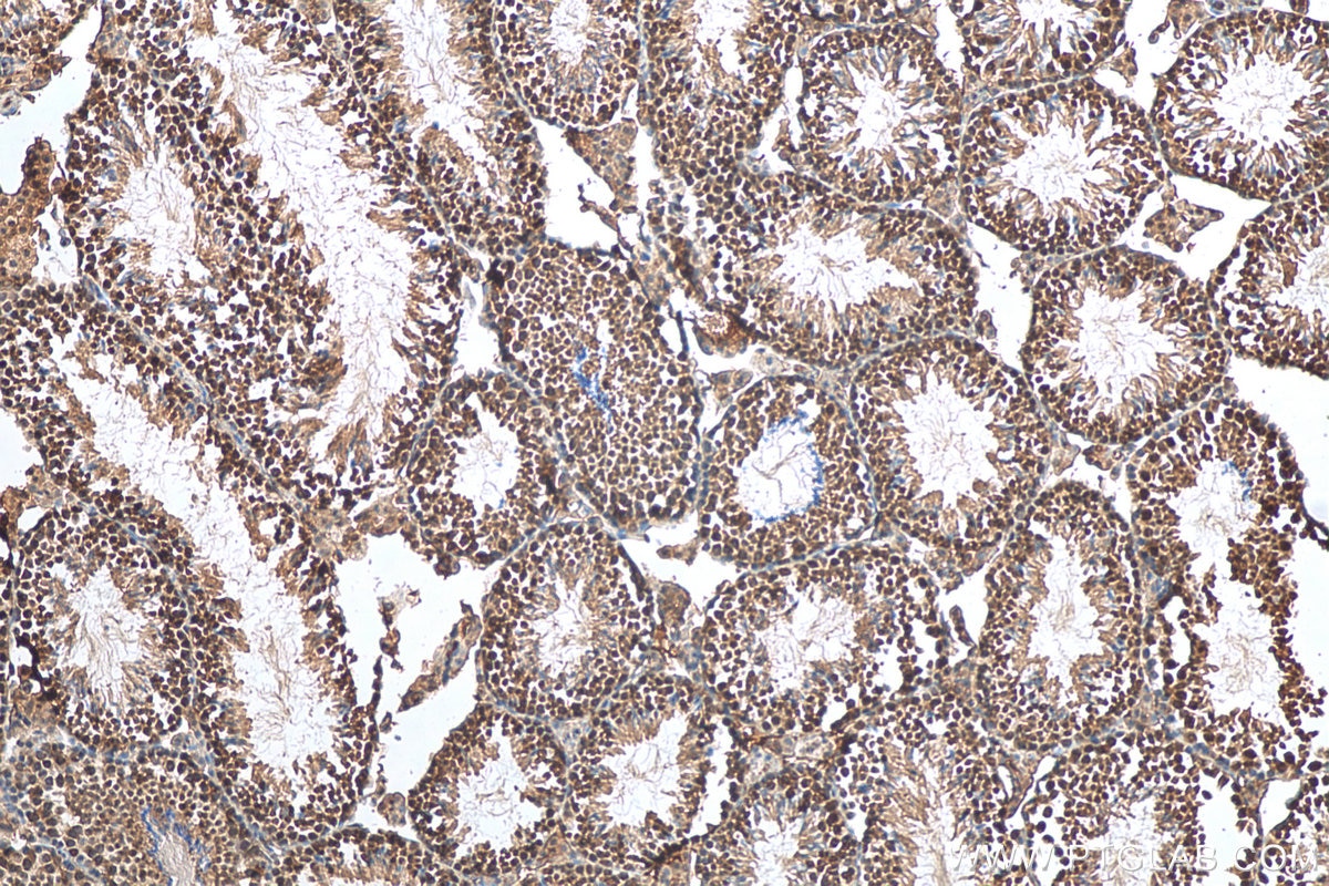 Immunohistochemistry (IHC) staining of mouse testis tissue using SART1 Polyclonal antibody (22675-1-AP)