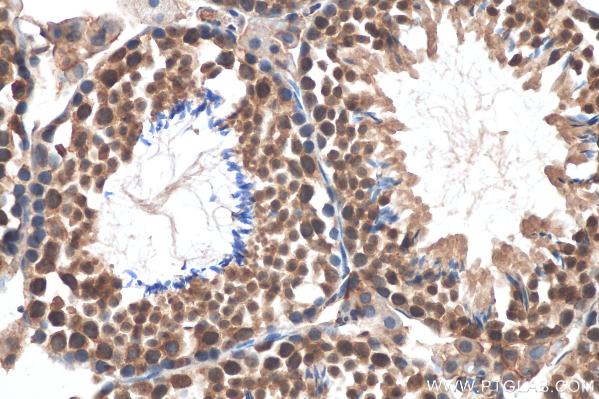 Immunohistochemistry (IHC) staining of mouse testis tissue using SART1 Polyclonal antibody (22675-1-AP)