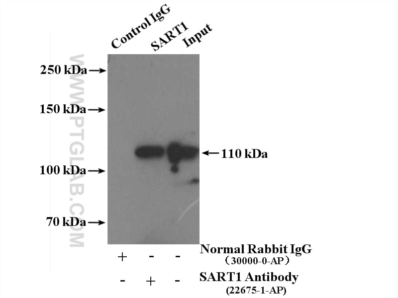 Immunoprecipitation (IP) experiment of mouse brain tissue using SART1 Polyclonal antibody (22675-1-AP)