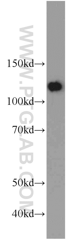 Western Blot (WB) analysis of Jurkat cells using SART1 Polyclonal antibody (22675-1-AP)