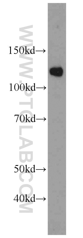 Western Blot (WB) analysis of HeLa cells using SART1 Polyclonal antibody (22675-1-AP)