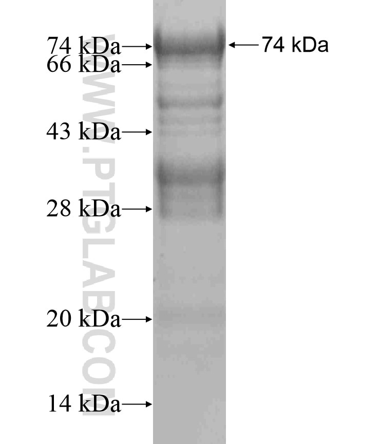 SART1 fusion protein Ag18478 SDS-PAGE