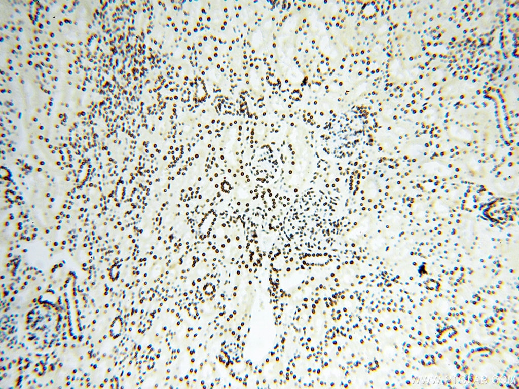 Immunohistochemistry (IHC) staining of human kidney tissue using SART3 Polyclonal antibody (18025-1-AP)