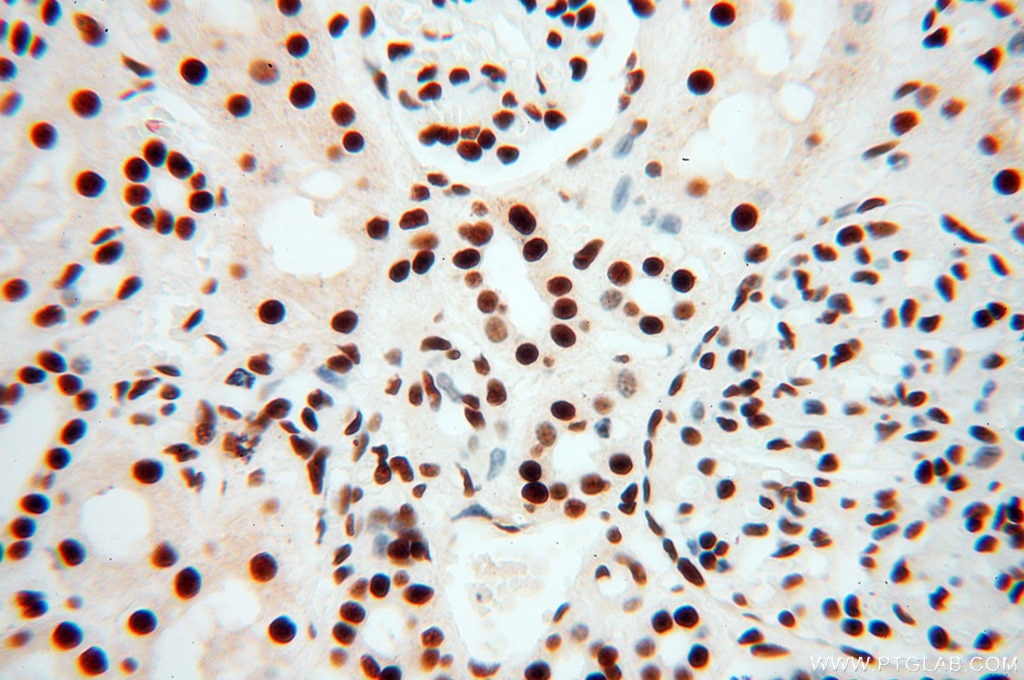Immunohistochemistry (IHC) staining of human kidney tissue using SART3 Polyclonal antibody (18025-1-AP)