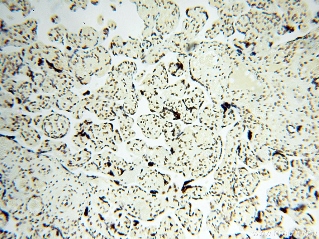 Immunohistochemistry (IHC) staining of human placenta tissue using SART3 Polyclonal antibody (18025-1-AP)