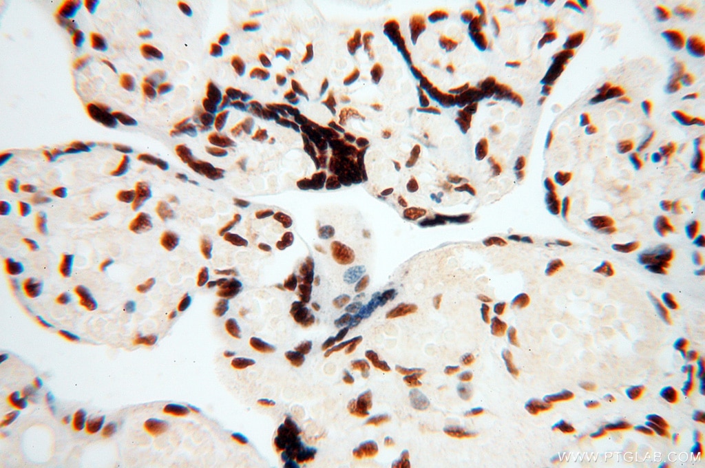 Immunohistochemistry (IHC) staining of human placenta tissue using SART3 Polyclonal antibody (18025-1-AP)