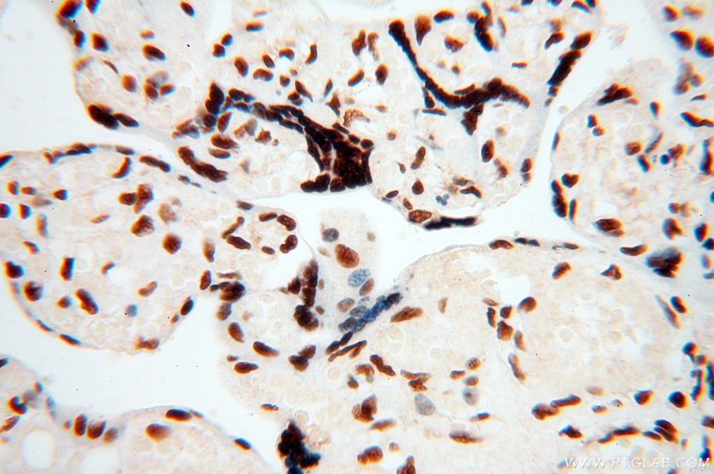 IHC staining of human placenta using 18025-1-AP