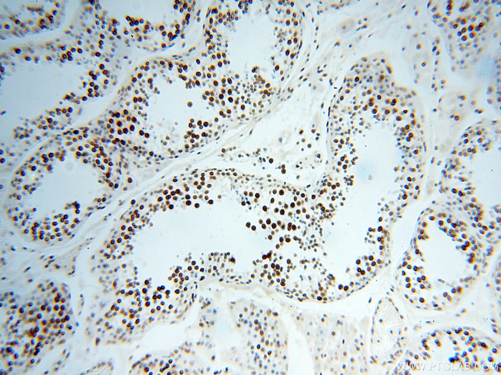 Immunohistochemistry (IHC) staining of human testis tissue using SART3 Polyclonal antibody (18025-1-AP)