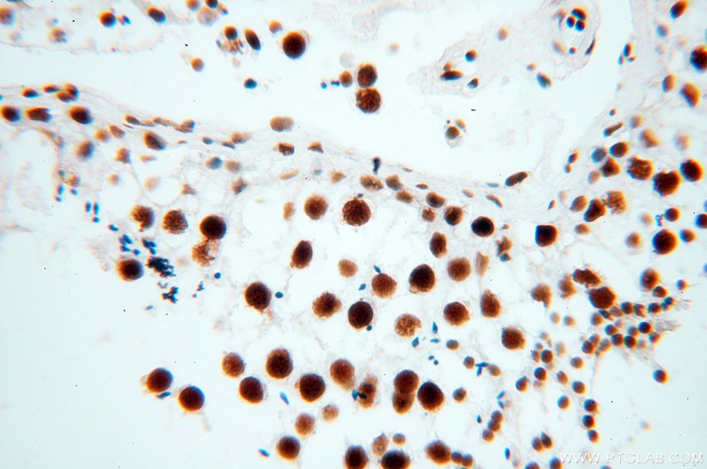 Immunohistochemistry (IHC) staining of human testis tissue using SART3 Polyclonal antibody (18025-1-AP)