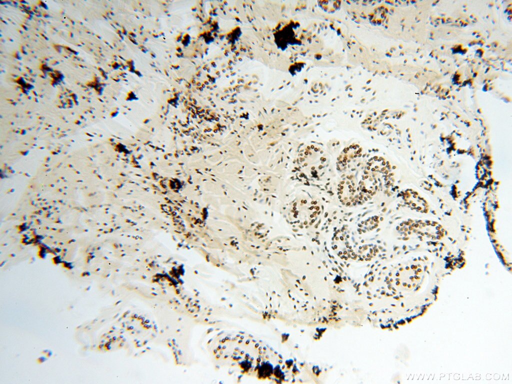 Immunohistochemistry (IHC) staining of human skin tissue using SART3 Polyclonal antibody (18025-1-AP)