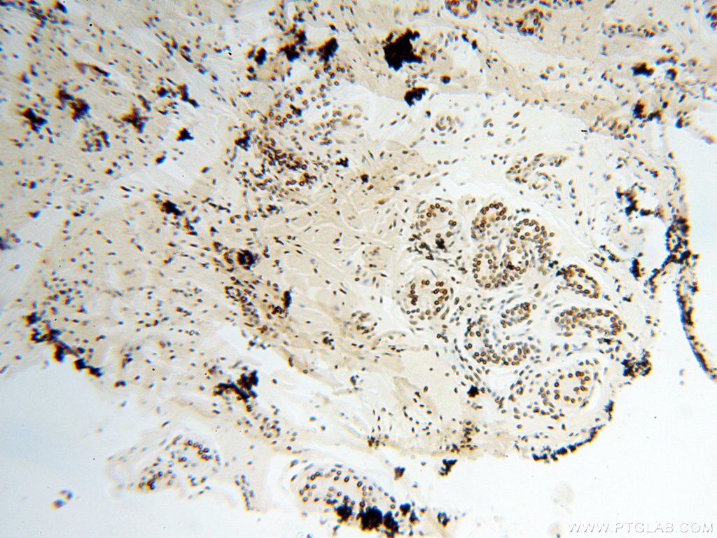 IHC staining of human skin using 18025-1-AP