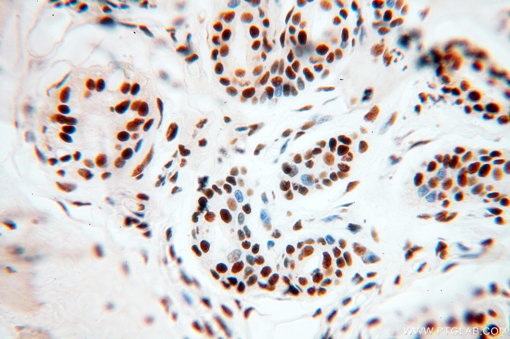 Immunohistochemistry (IHC) staining of human skin tissue using SART3 Polyclonal antibody (18025-1-AP)
