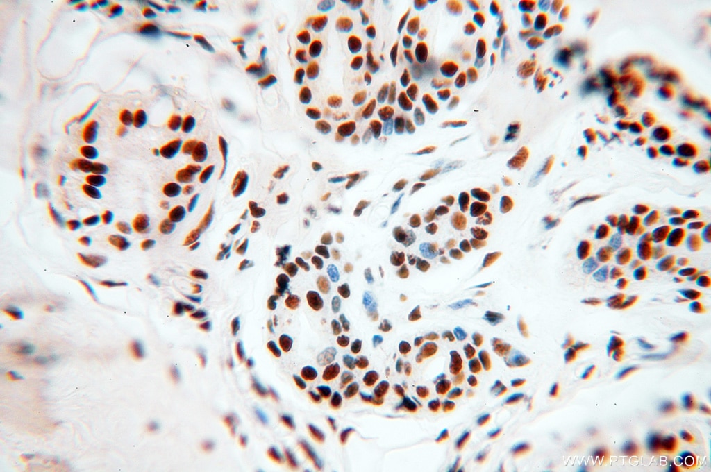 IHC staining of human skin using 18025-1-AP