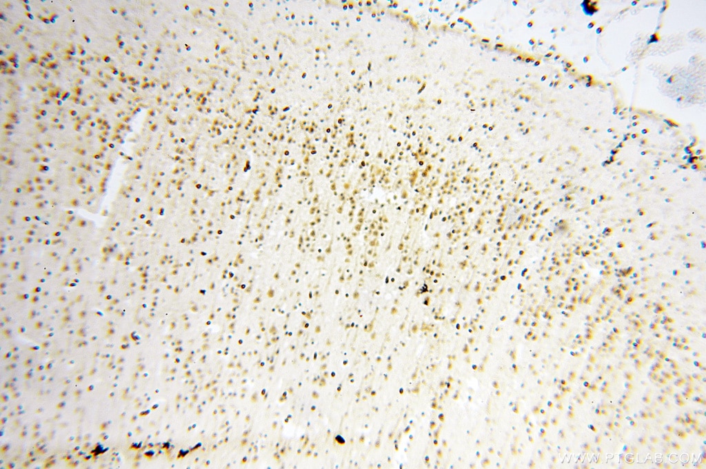 Immunohistochemistry (IHC) staining of human brain tissue using SART3 Polyclonal antibody (18025-1-AP)