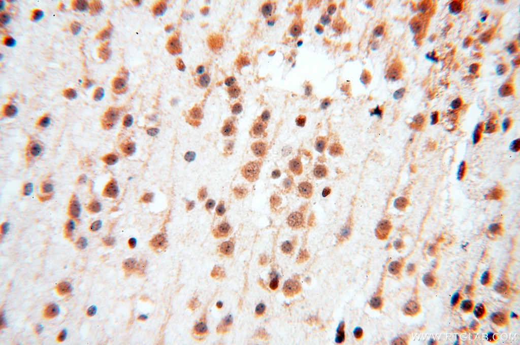 Immunohistochemistry (IHC) staining of human brain tissue using SART3 Polyclonal antibody (18025-1-AP)