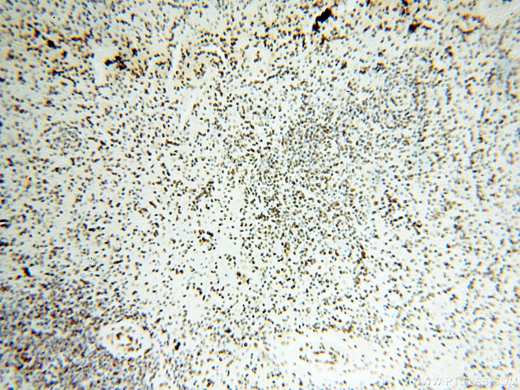 Immunohistochemistry (IHC) staining of human spleen tissue using SART3 Polyclonal antibody (18025-1-AP)
