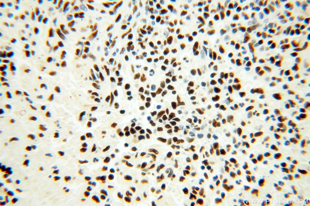 Immunohistochemistry (IHC) staining of human spleen tissue using SART3 Polyclonal antibody (18025-1-AP)