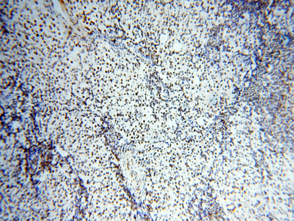 Immunohistochemistry (IHC) staining of human ovary tissue using SART3 Polyclonal antibody (18025-1-AP)
