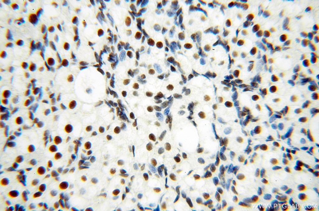 Immunohistochemistry (IHC) staining of human ovary tissue using SART3 Polyclonal antibody (18025-1-AP)