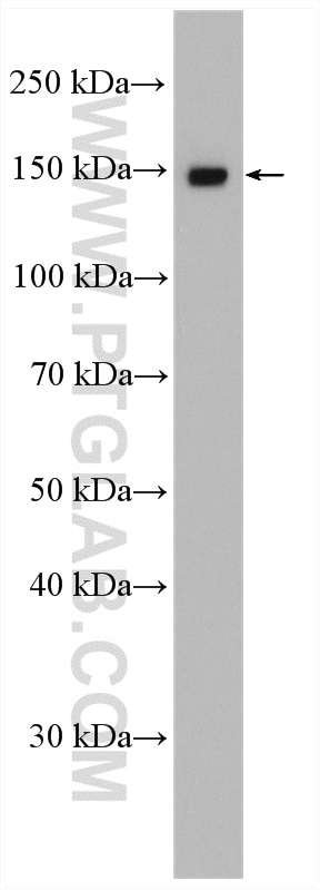 Western Blot (WB) analysis of Jurkat cells using SART3 Polyclonal antibody (18025-1-AP)