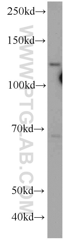 Western Blot (WB) analysis of Jurkat cells using SART3 Polyclonal antibody (18025-1-AP)