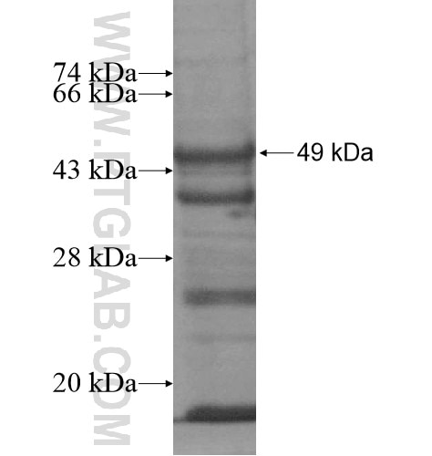 SART3 fusion protein Ag13277 SDS-PAGE