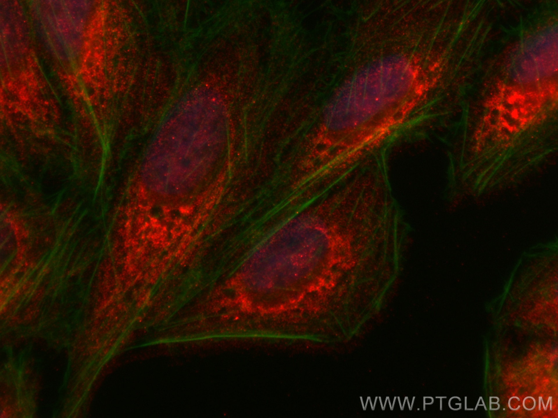 Immunofluorescence (IF) / fluorescent staining of U2OS cells using SASH1 Polyclonal antibody (27689-1-AP)