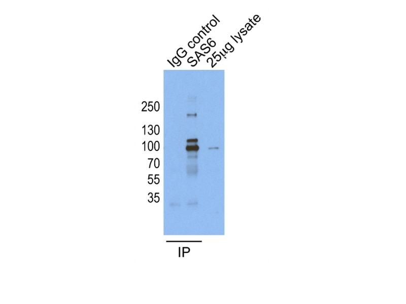 Immunoprecipitation (IP) experiment of HeLa cells using SASS6 Polyclonal antibody (21377-1-AP)