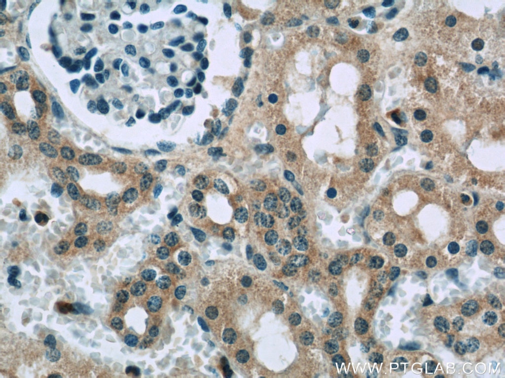 Immunohistochemistry (IHC) staining of human kidney tissue using SASS6 Polyclonal antibody (21377-1-AP)