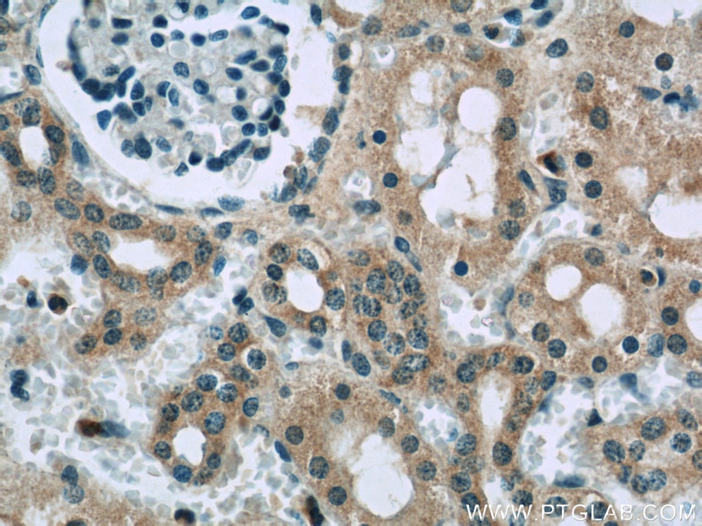 IHC staining of human kidney using 21377-1-AP