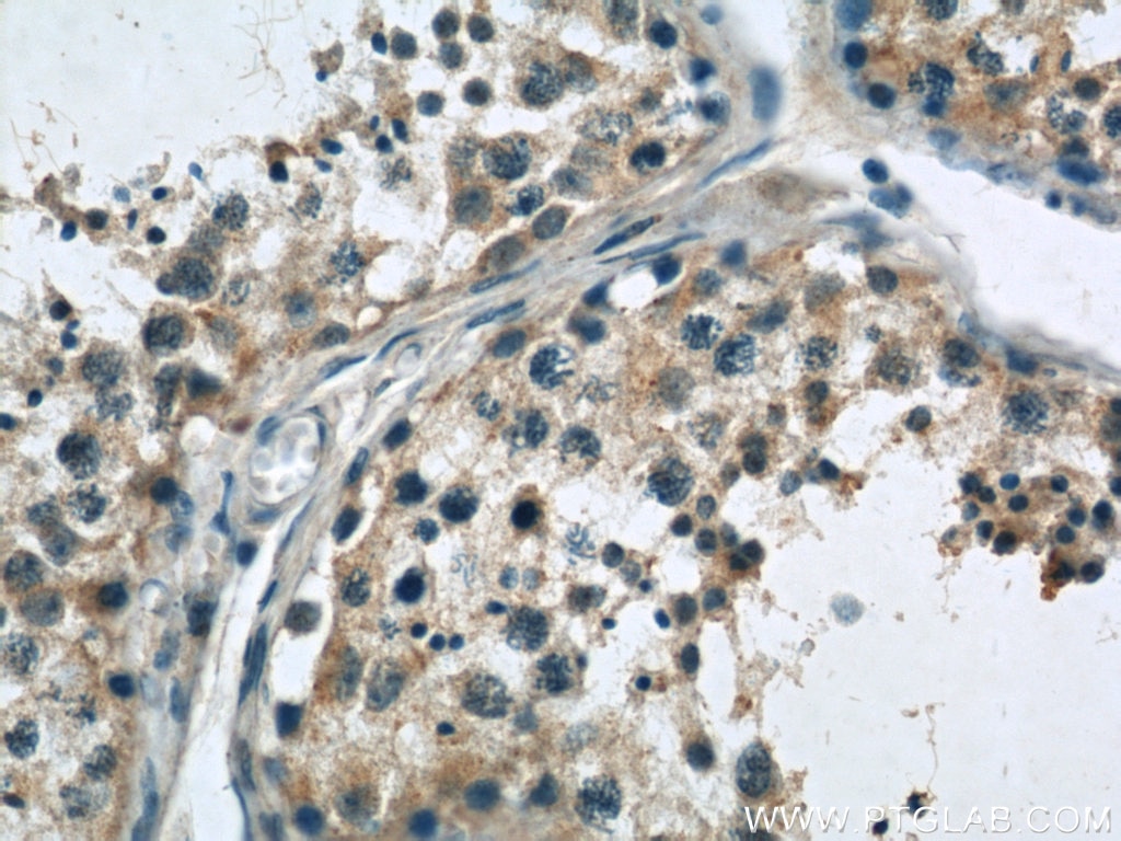 Immunohistochemistry (IHC) staining of human testis tissue using SASS6 Polyclonal antibody (21377-1-AP)