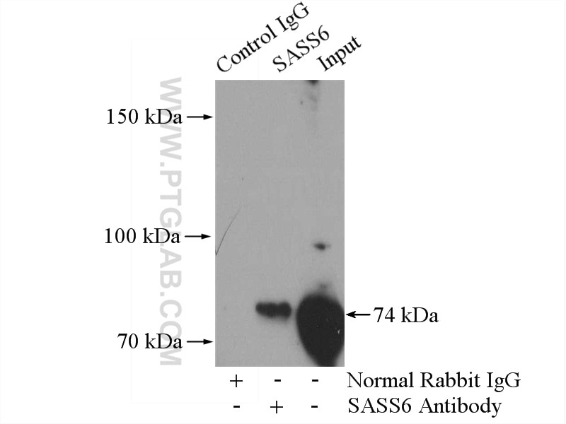 Immunoprecipitation (IP) experiment of HeLa cells using SASS6 Polyclonal antibody (21377-1-AP)