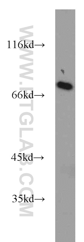 Western Blot (WB) analysis of HeLa cells using SASS6 Polyclonal antibody (21377-1-AP)