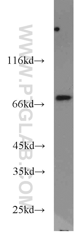 Western Blot (WB) analysis of MCF-7 cells using SASS6 Polyclonal antibody (21377-1-AP)