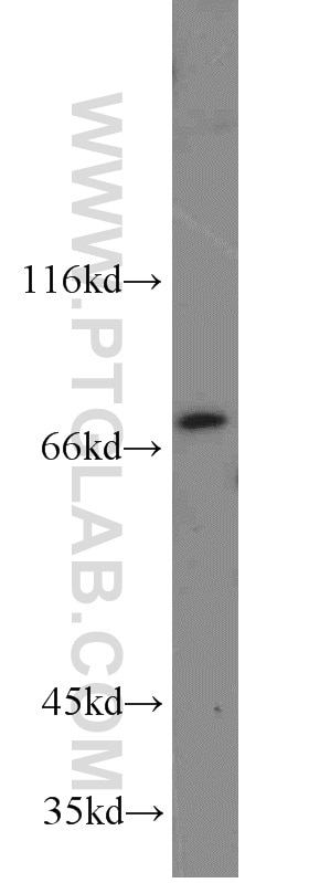 Western Blot (WB) analysis of human testis tissue using SASS6 Polyclonal antibody (21377-1-AP)