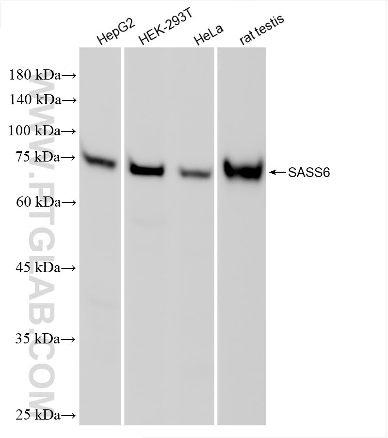 Western Blot (WB) analysis of various lysates using SASS6 Recombinant antibody (86251-1-RR)