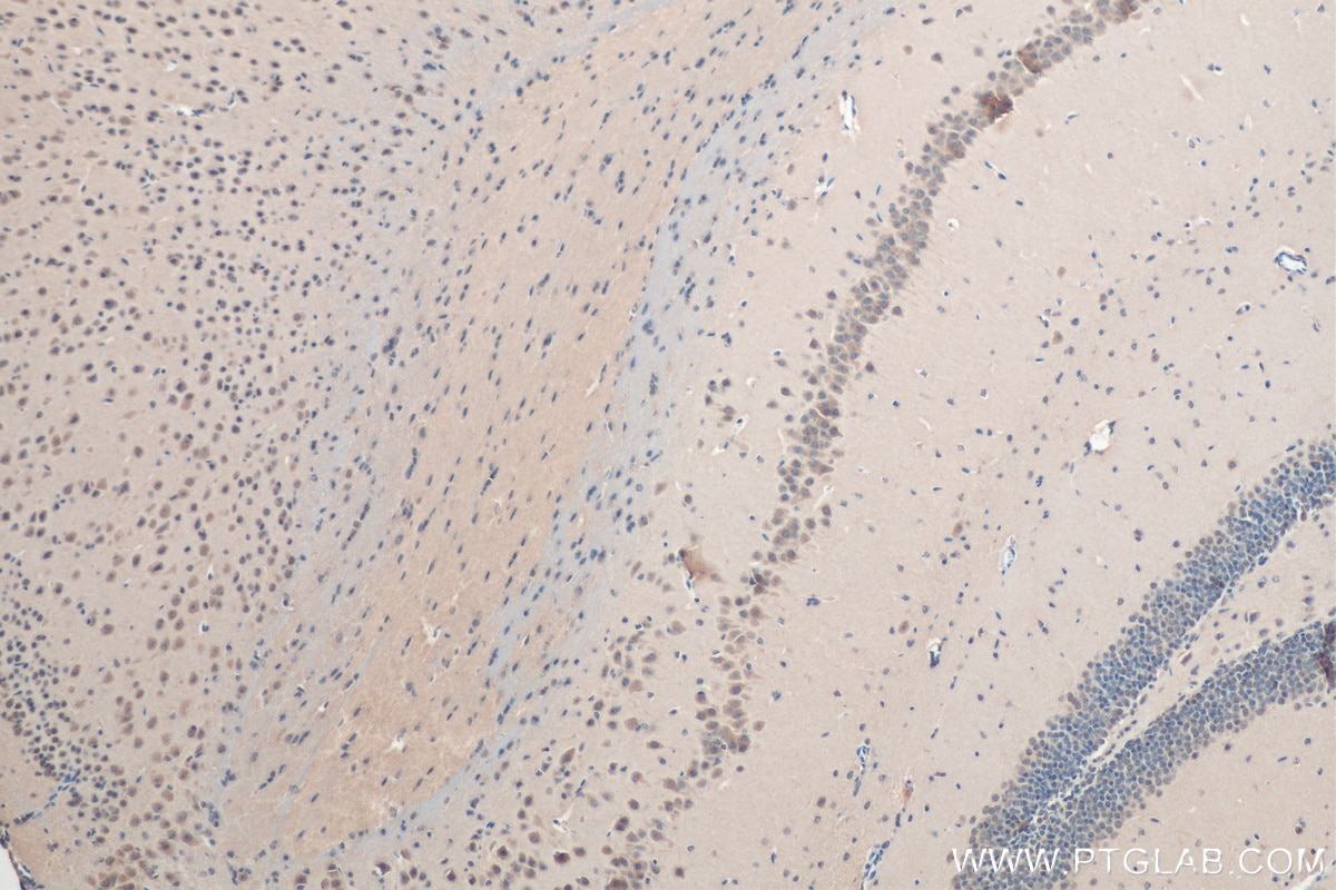 Immunohistochemistry (IHC) staining of mouse brain tissue using SAT1 Polyclonal antibody (10708-1-AP)